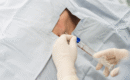 How Epidural Injections Help Relieve Back and Leg Pain