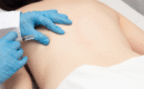 Why Trigger Point Injections Are Commonly Used in Chronic Pain Management