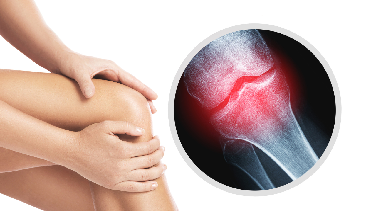 What Is Degenerative Joint Disease and How Is It Treated?